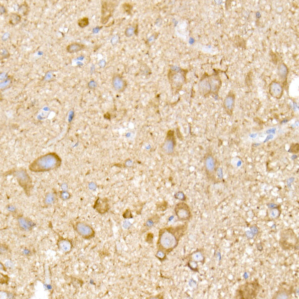 NgR3 Rabbit mAb