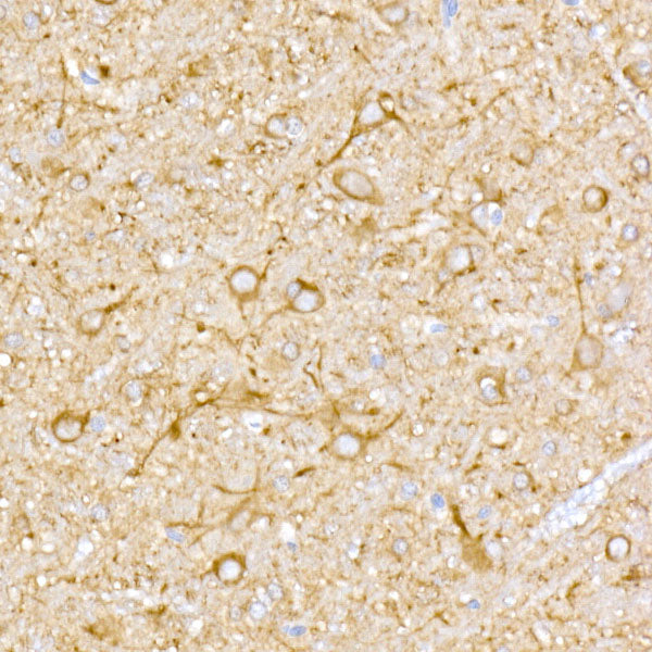 NgR3 Rabbit mAb