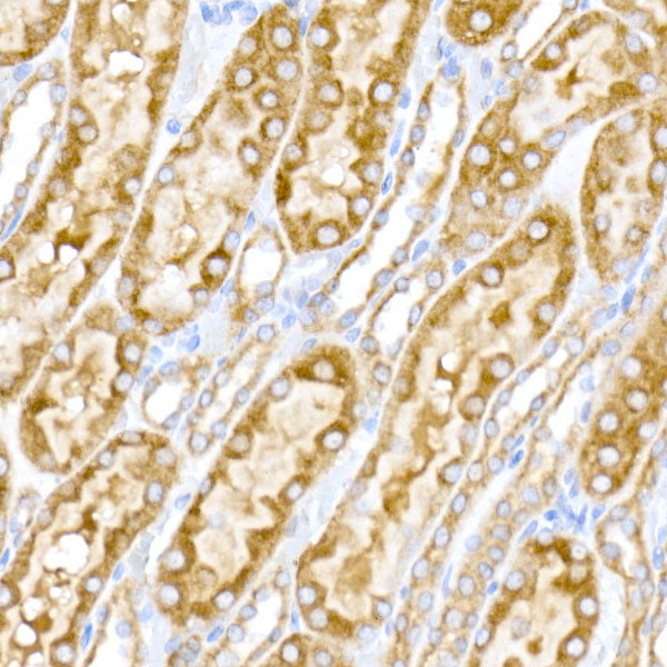 NgR3 Rabbit mAb