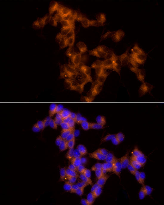 NgR3 Rabbit mAb