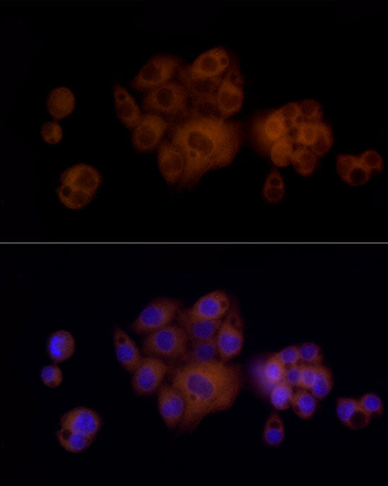 PAH Rabbit mAb