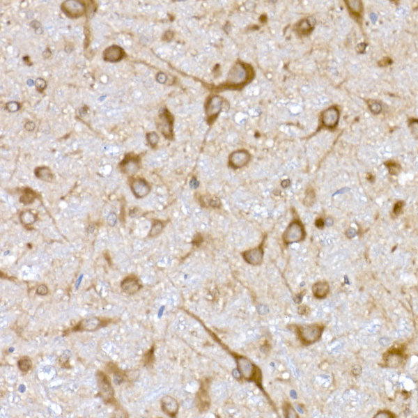 USO1 Rabbit mAb