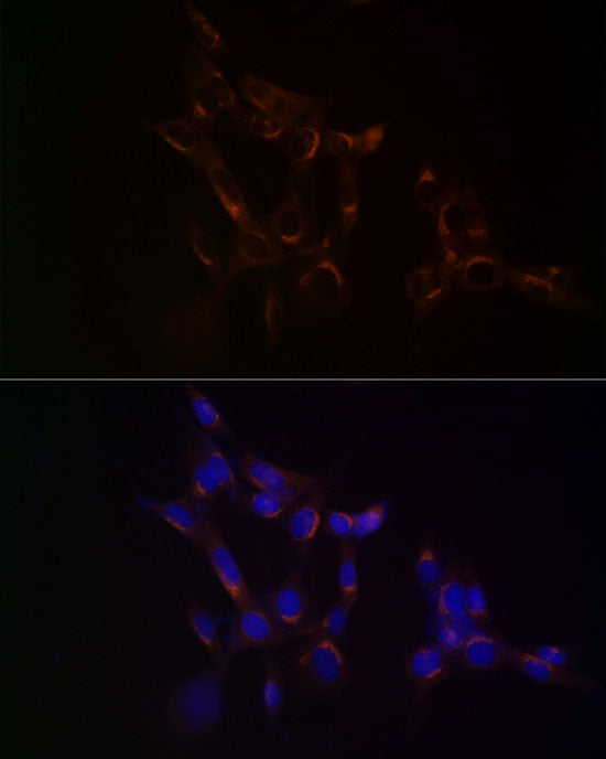 USO1 Rabbit mAb