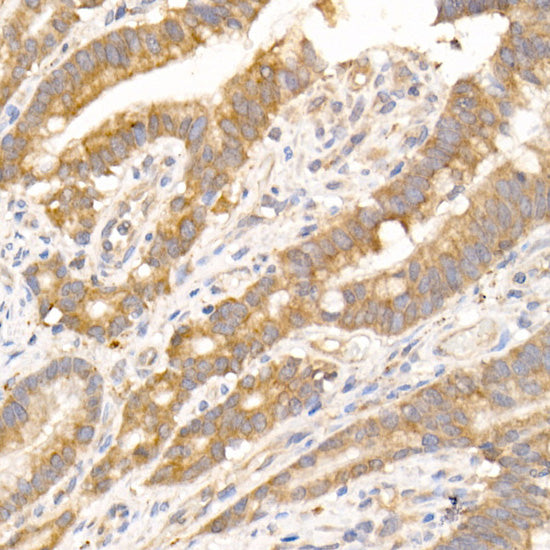NUDT19 Rabbit mAb