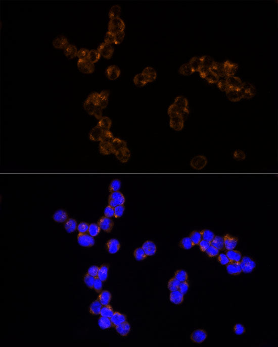 NUDT19 Rabbit mAb