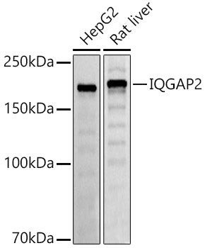 IQGAP2 Rabbit mAb