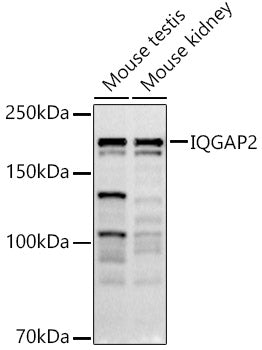IQGAP2 Rabbit mAb