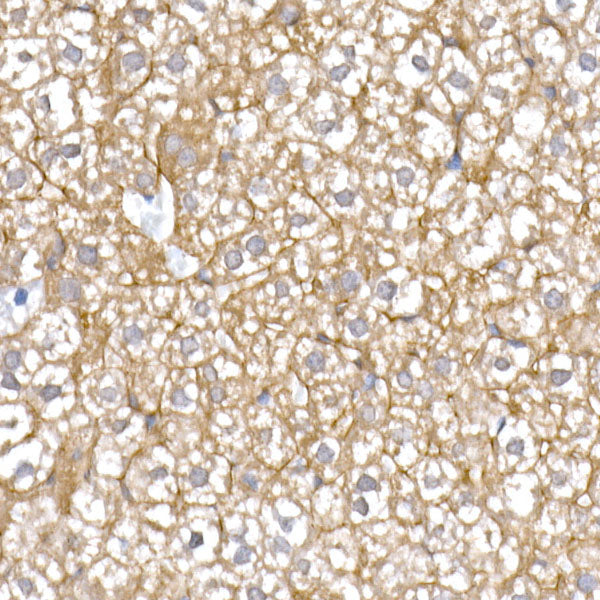 IQGAP2 Rabbit mAb