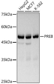 PREB Rabbit mAb