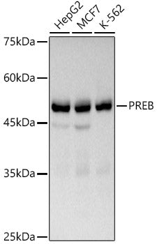 PREB Rabbit mAb