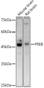 PREB Rabbit mAb