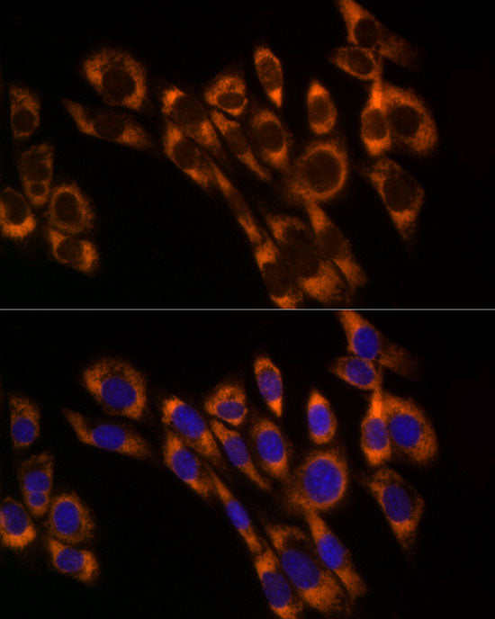 PREB Rabbit mAb
