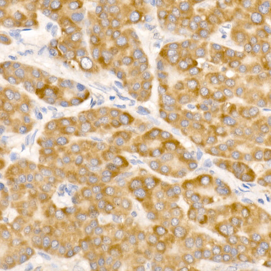 ATP5G1 Rabbit mAb