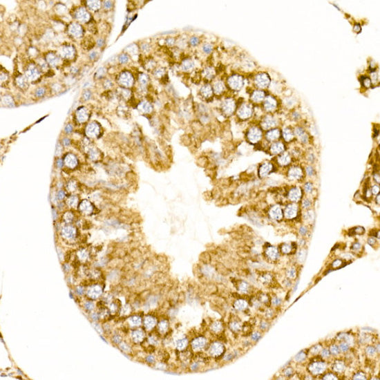 ATP5G1 Rabbit mAb