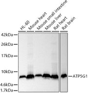 ATP5G1 Rabbit mAb