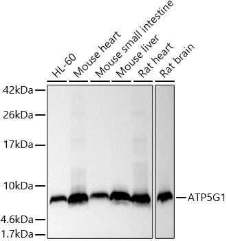 ATP5G1 Rabbit mAb