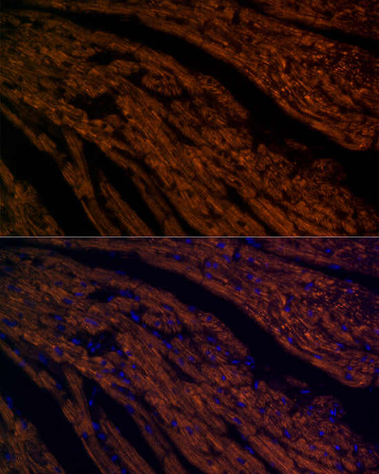 ATP5G1 Rabbit mAb