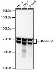 HNRNPM Rabbit mAb