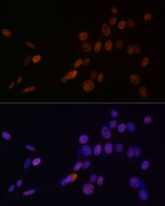 HNRNPM Rabbit mAb