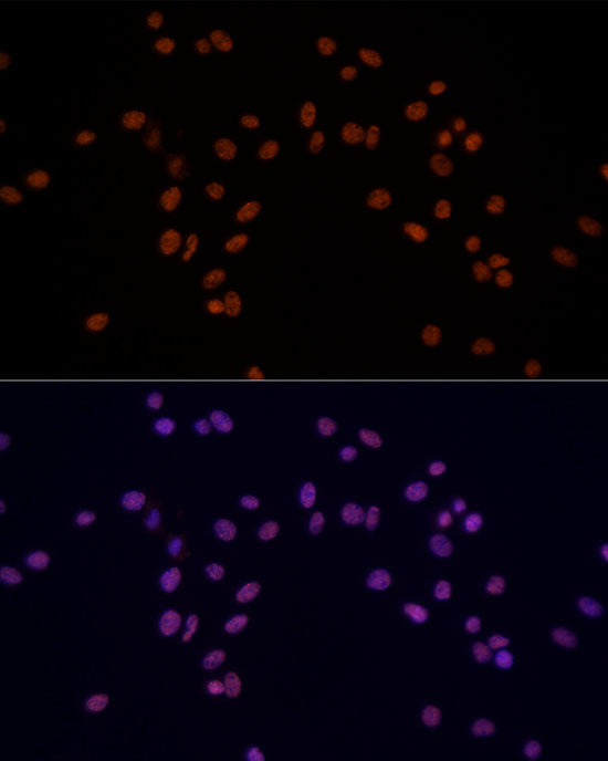 HNRNPM Rabbit mAb