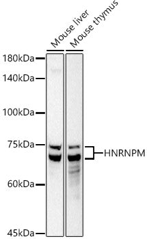HNRNPM Rabbit mAb