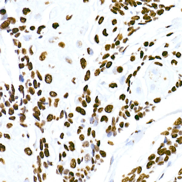 HNRNPM Rabbit mAb