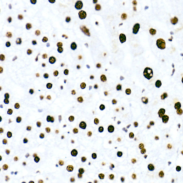 HNRNPM Rabbit mAb