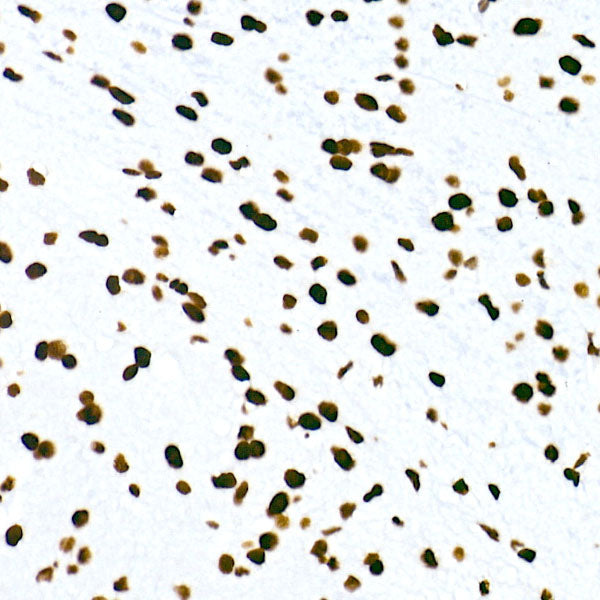 HNRNPM Rabbit mAb