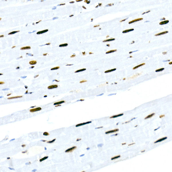 HNRNPM Rabbit mAb