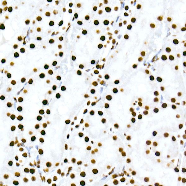 HNRNPM Rabbit mAb