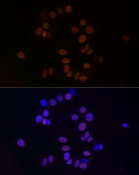 HNRNPM Rabbit mAb