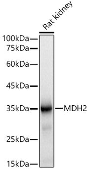 MDH2 Rabbit mAb