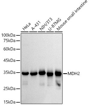 MDH2 Rabbit mAb