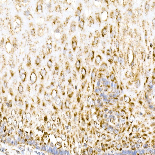 MDH2 Rabbit mAb