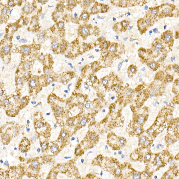 MDH2 Rabbit mAb