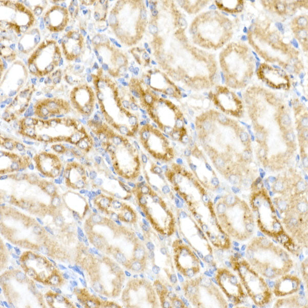 MDH2 Rabbit mAb