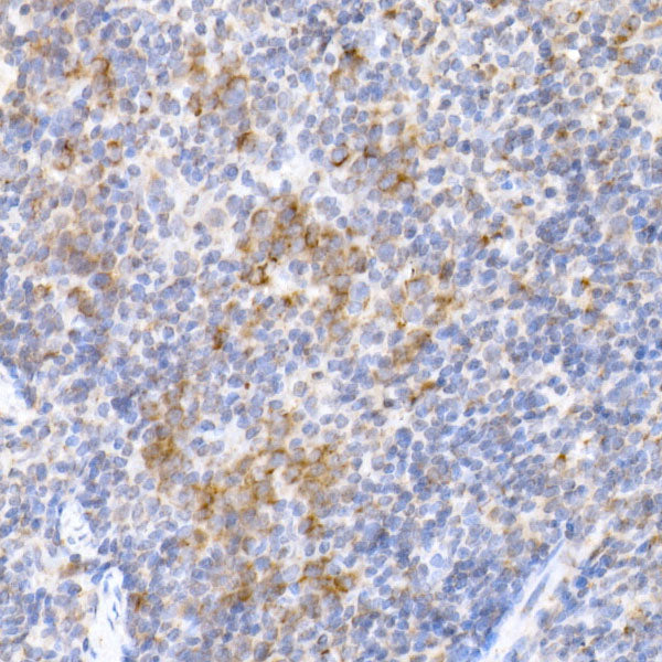 MDH2 Rabbit mAb