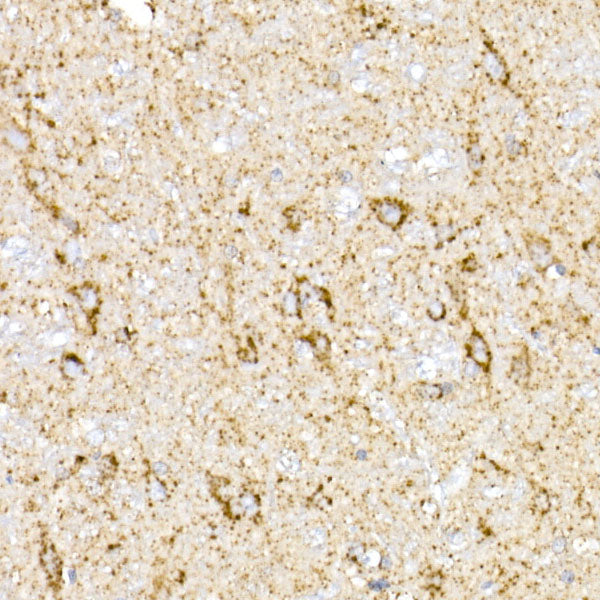 MDH2 Rabbit mAb