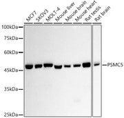 PSMC5 Rabbit mAb