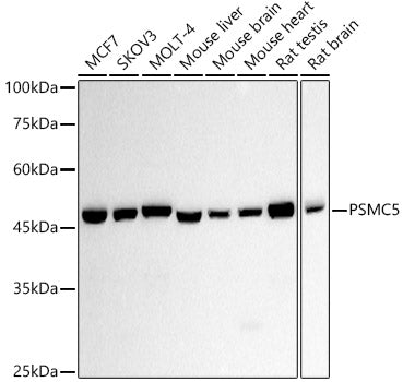PSMC5 Rabbit mAb