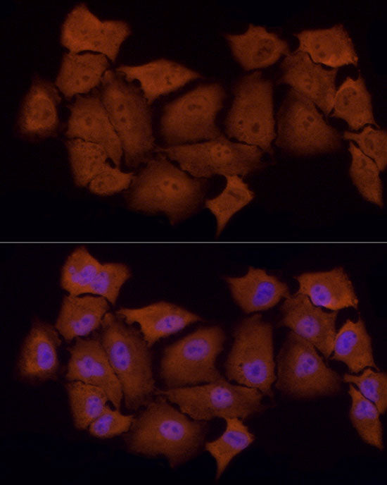 PSMC5 Rabbit mAb