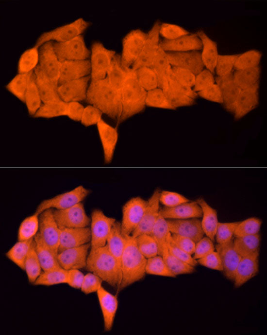 PSMC5 Rabbit mAb