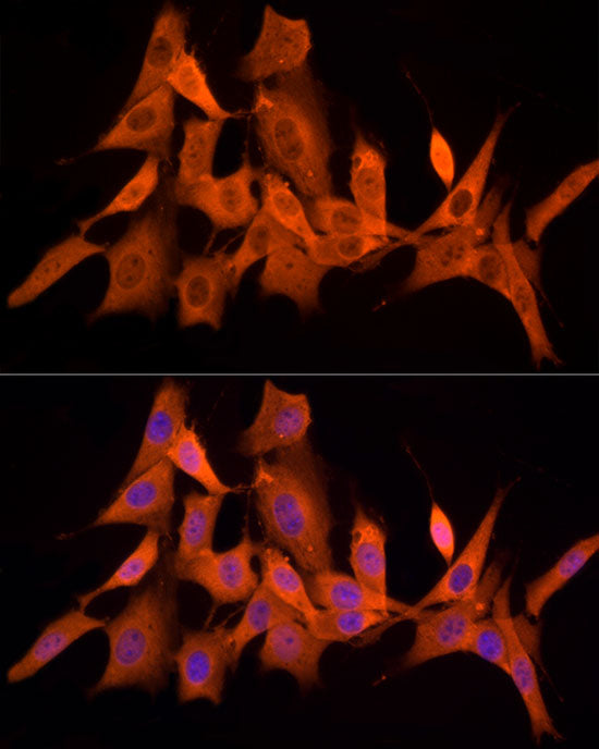 PSMC5 Rabbit mAb