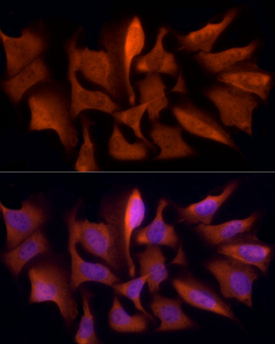 PSMC5 Rabbit mAb