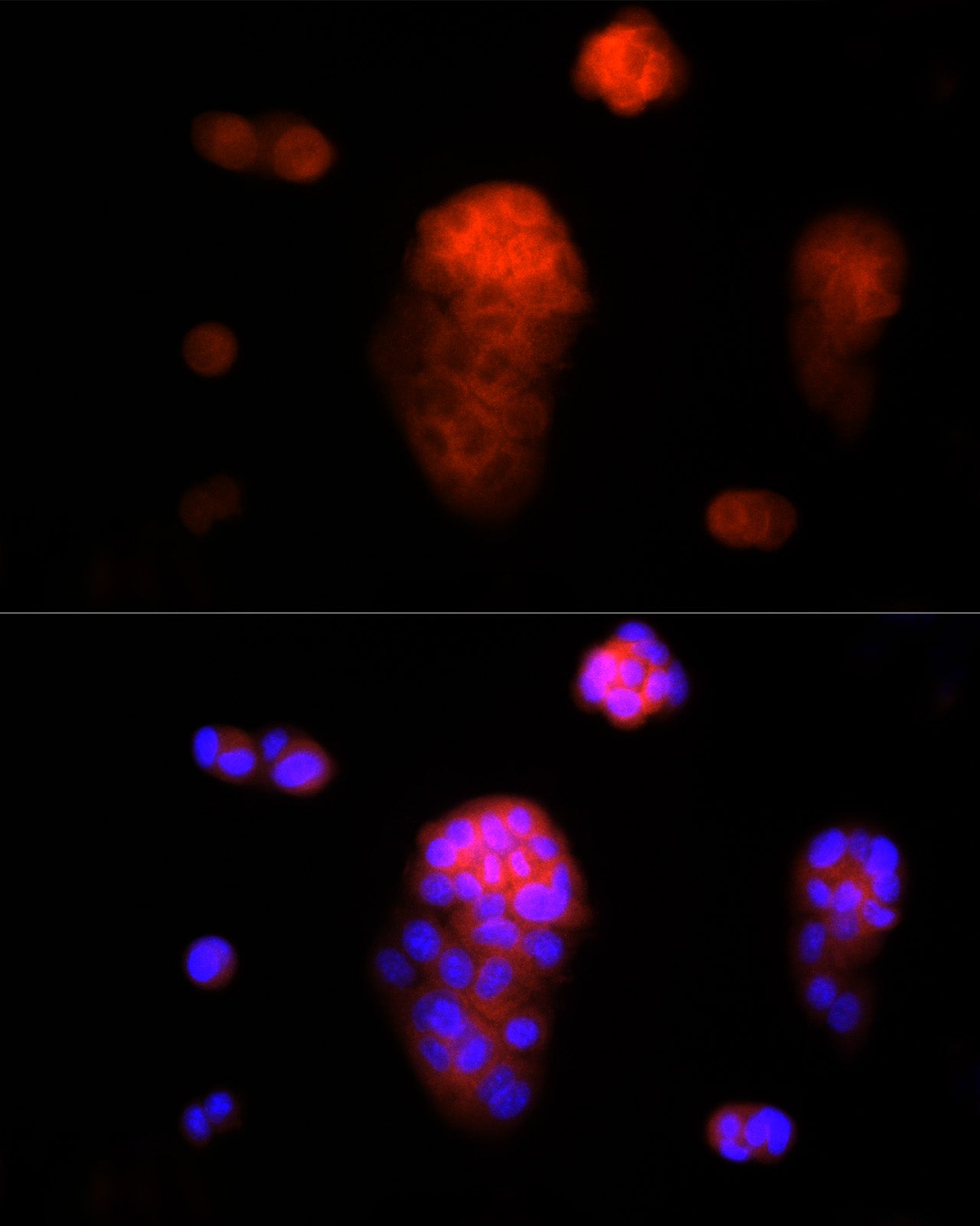AAMP Rabbit mAb