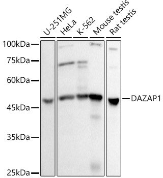 DAZAP1 Rabbit mAb