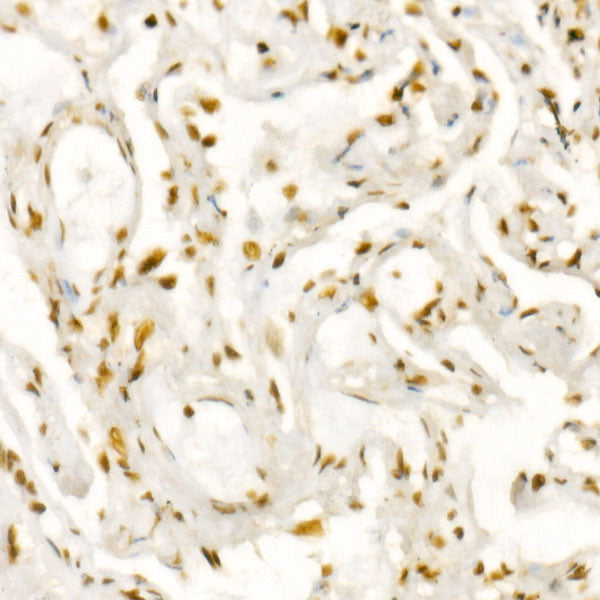 DAZAP1 Rabbit mAb