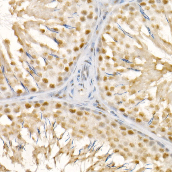 DAZAP1 Rabbit mAb