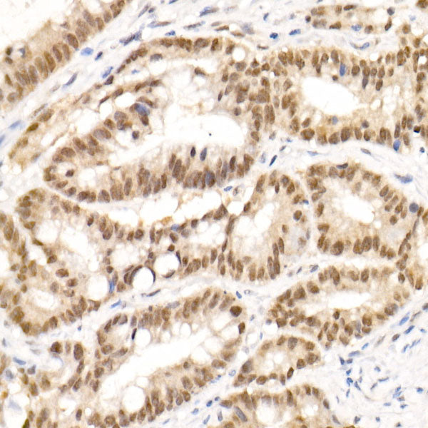 TCEA1 Rabbit mAb