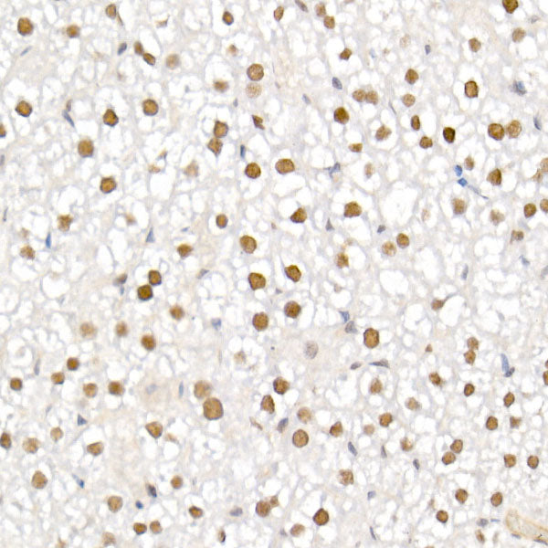 TCEA1 Rabbit mAb